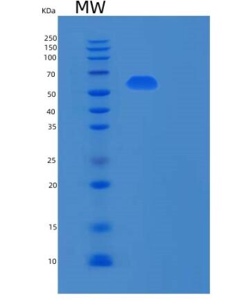 Recombinant Human RPN2 Protein