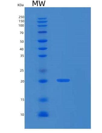 Recombinant Human RPS10 Protein
