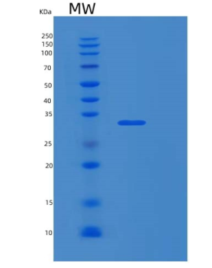 Recombinant Human RPS3A Protein