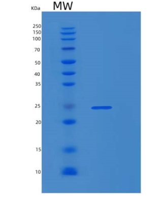 Recombinant Human RPS5 Protein