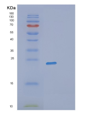 Recombinant Human RWDD4 Protein