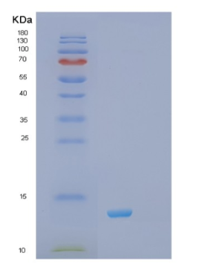 Recombinant Human RXR-α( Retinoid x receptor) Protein