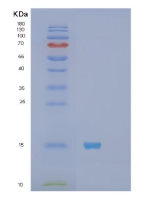 Recombinant Human S100A11 Protein