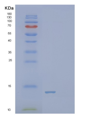Recombinant Human S100A14 Protein