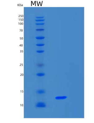 Recombinant Human S100A16 Protein