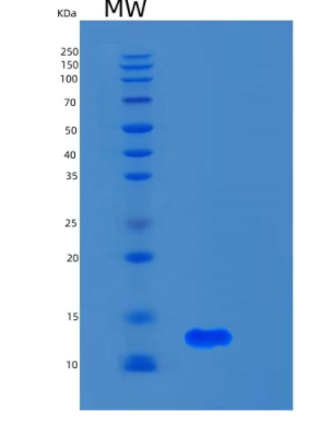 Recombinant Human S100A5 Protein