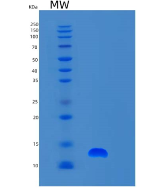 Recombinant Human S100A6 Protein