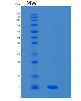 Recombinant Human S100A8 Protein