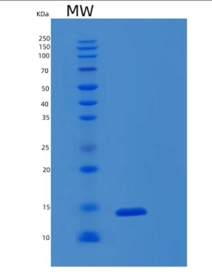 Recombinant Human S100A9 Protein