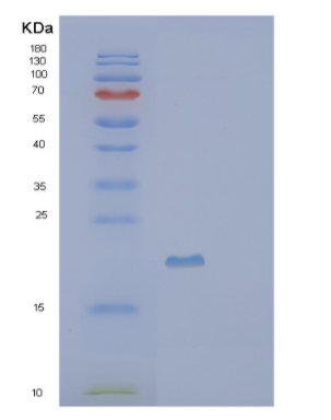 Recombinant Human SCG5 Protein