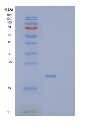 Recombinant Human SCP2D1 Protein