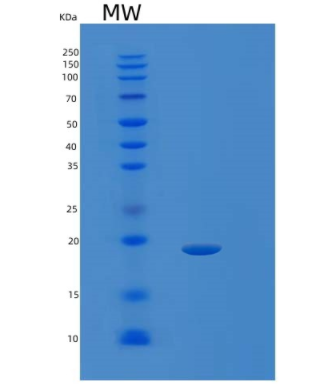 Recombinant Human SDHAF2 Protein