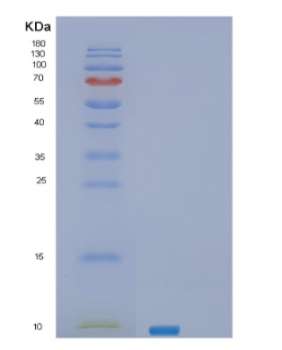 Recombinant Human SEC61B Protein