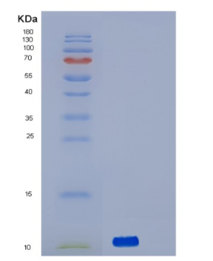 Recombinant Human Serine/threonine-protein kinase receptor R3 Protein