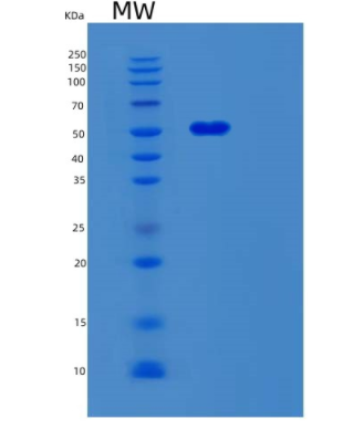 Recombinant Human SERPINC1 Protein