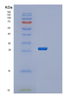 Recombinant Human SERTAD1 Protein
