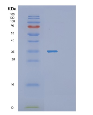 Recombinant Human SET Protein