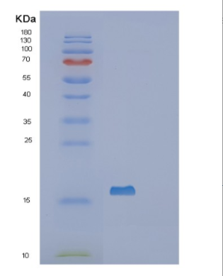 Recombinant Human SF3B14 Protein