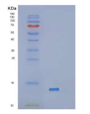Recombinant Human Serum Amyloid A Protein
