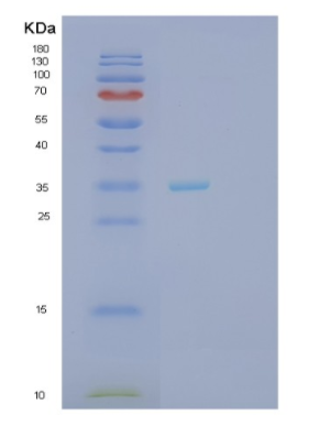 Recombinant Human SFRP5 Protein