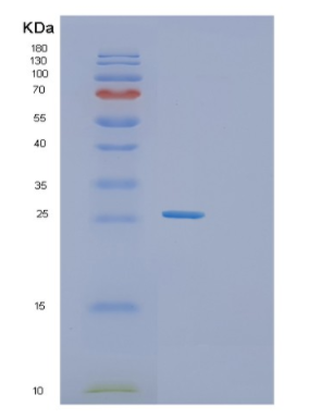 Recombinant Human SGCB Protein