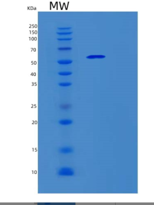 Recombinant Human SERPING1 Protein