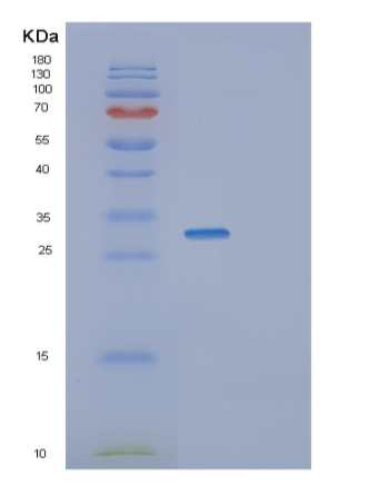 Recombinant Human SFRS1 Protein