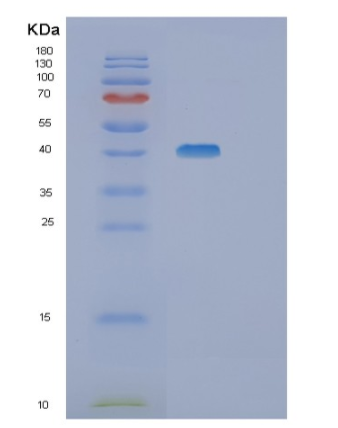 Recombinant Human SGK1 Protein