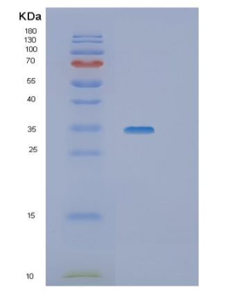 Recombinant Human SGTA Protein