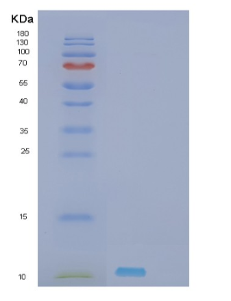 Recombinant Human SHFM1 Protein