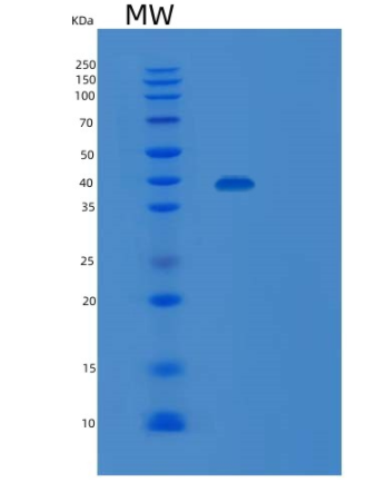 Recombinant Human SIRPA Protein