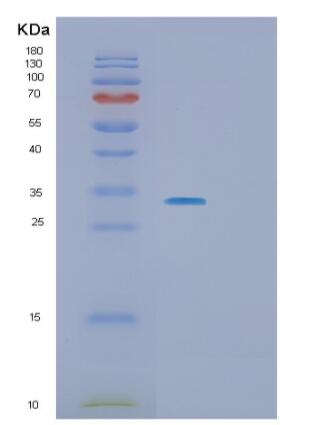 Recombinant Human SLA2 Protein