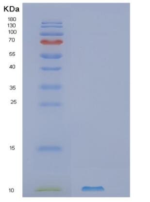 Recombinant Human SLC51B Protein