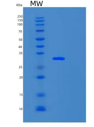 Recombinant Human SNAI2 Protein