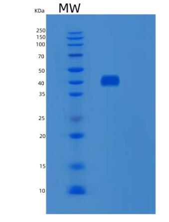 Recombinant Human SNX5 Protein