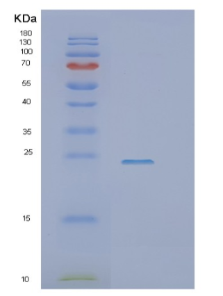 Recombinant Human SSR1 Protein