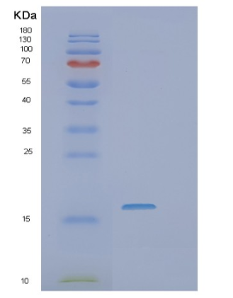 Recombinant Human SSR4 Protein