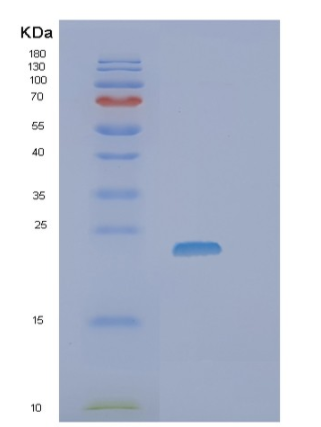 Recombinant Human SSSCA1 Protein