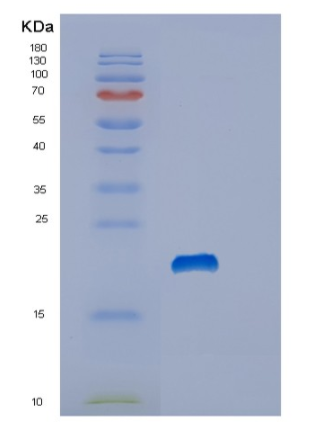 Recombinant Human Stathmin Protein