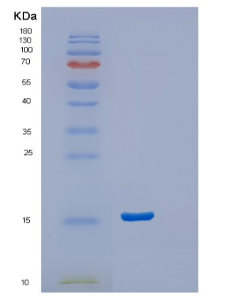 Recombinant Human Stathmin-2 Protein