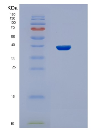 Recombinant Human STBD1 Protein