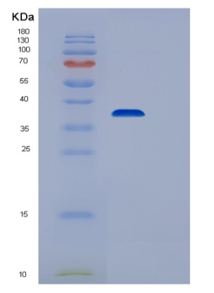 Recombinant Human STIM1 Protein