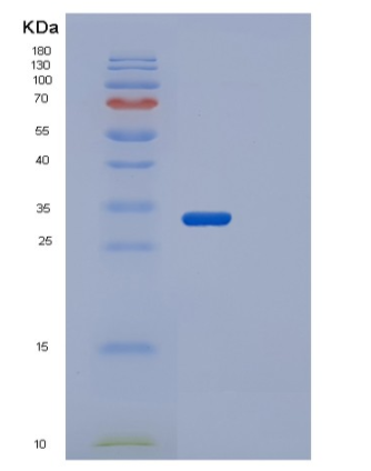 Recombinant Human STK17A Protein