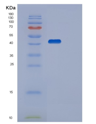 Recombinant Human STK17B Protein
