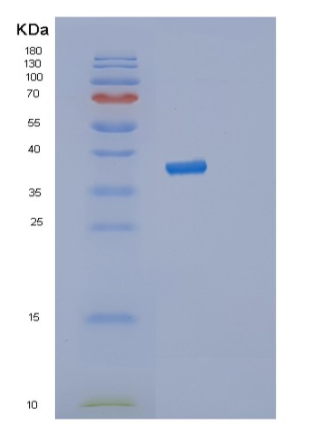 Recombinant Human STK3 Protein