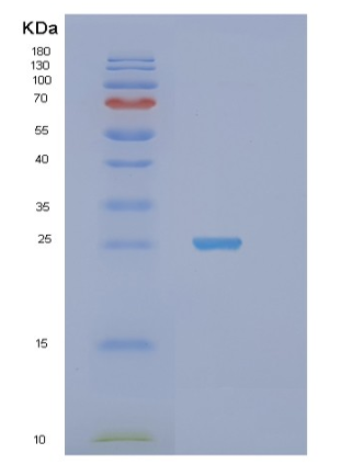 Recombinant Human STXBP6 Protein
