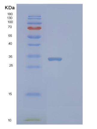 Recombinant Human STYX Protein