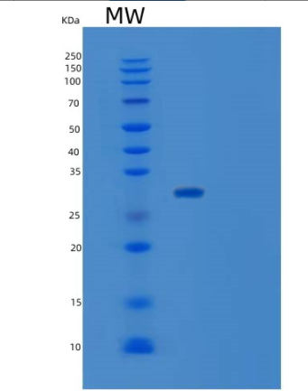 Recombinant Human SUGT1 Protein