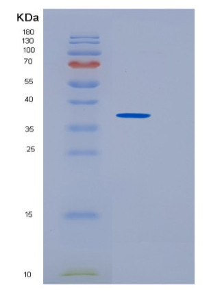 Recombinant Human SULT1B1 Protein