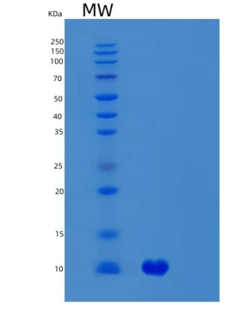 Recombinant Human SVIP Protein